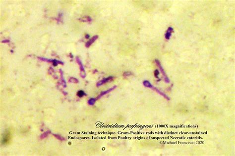 Clostridium Perfringens Gram Stain