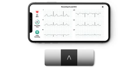 KardiaMobile 6L provides FDA-approved 6-lead ECG for $149 - 9to5Mac