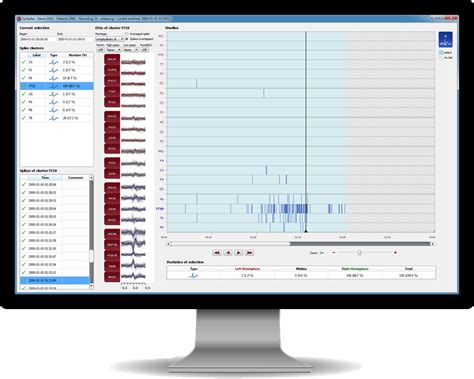 Spike Detection - encevis