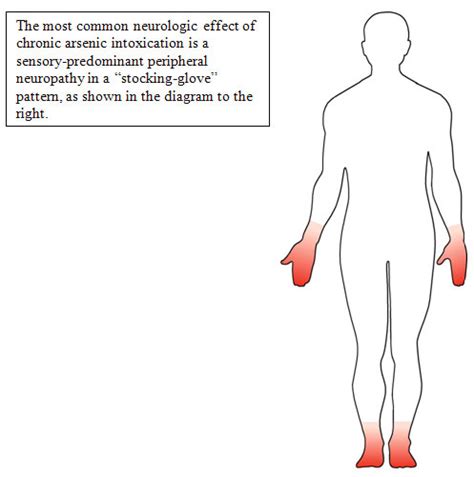 arsenic poisoning treatment - pictures, photos