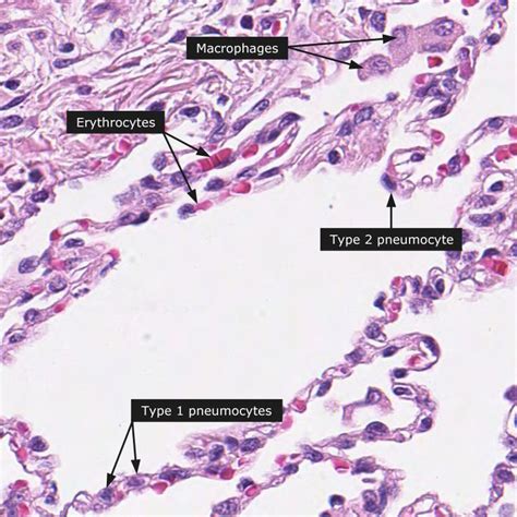 110 best Histology - Respiratory images on Pinterest | Lunges, Lungs ...