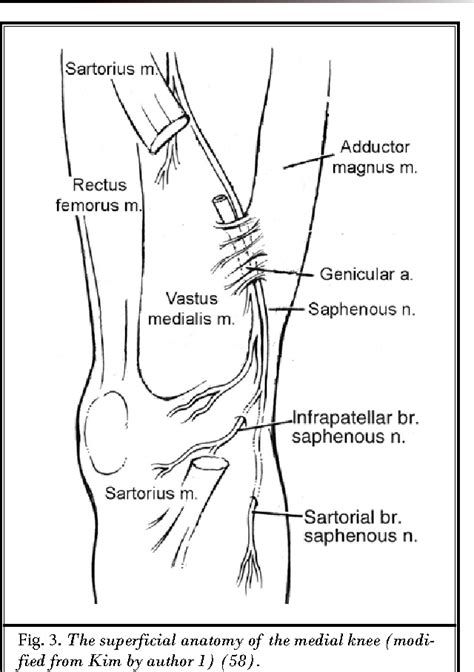 Figure 3 from Infrapatellar saphenous neuralgia - diagnosis and treatment. | Semantic Scholar