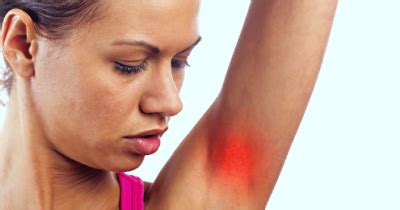 Arm Lump - Symptoms, Causes, Treatments | Healthgrades.com