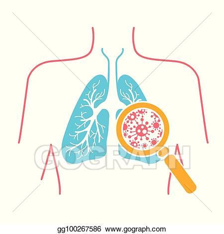 pneumonia clipart 10 free Cliparts | Download images on Clipground 2024