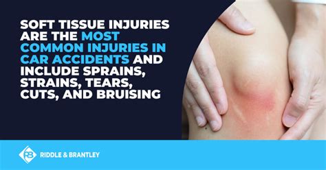 What Are Soft Tissue Injuries Caused by Car Accidents? | Riddle & Brantley