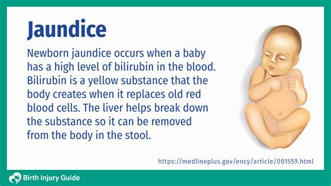 Newborn Jaundice | Birth Injury Guide