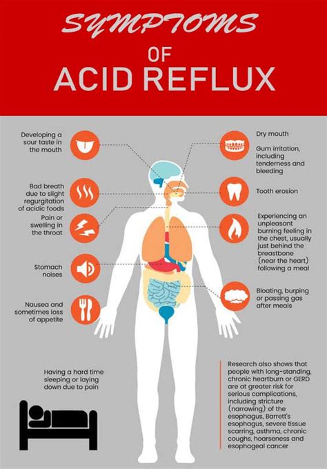 Symptoms of Acid Reflux