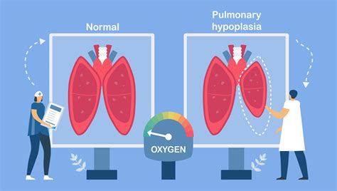 Pulmonary hypoplasia about restrictive lung disease. 1228964 Vector Art ...