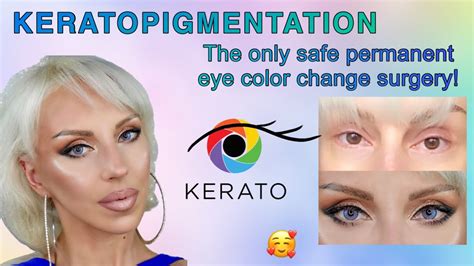 I CHANGED MY EYE COLOR AT KERATONYC, KERATOPIGMENTATION, FRENCH BLUE, MEDIUM INTENSITY - YouTube