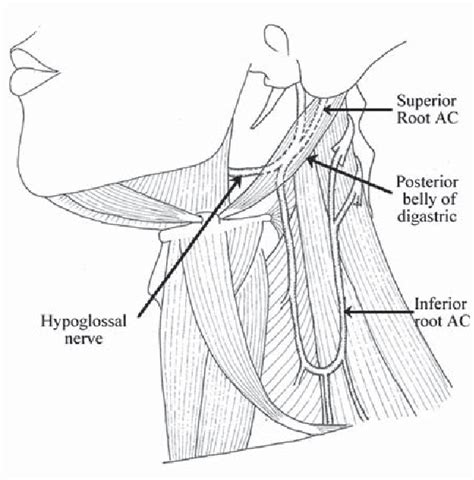 Figure 2 from Variations in the anatomy of ansa cervicalis. | Semantic Scholar