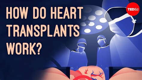 How does heart transplant surgery work? - Roni Shanoada