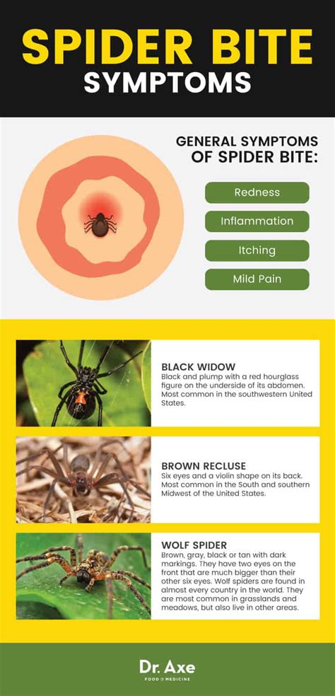 Spider Bite Symptoms + How & When to Treat Them at Home - Dr. Axe