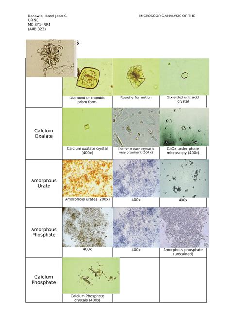 Urine_Sediments - Banawis, Hazel Jean C. URINE MD (AUB 323) MICROSCOPIC ...