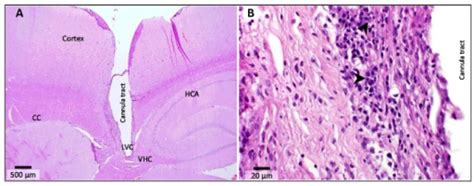 Histology of cannulated lateral ventricle.A) Cross-sect | Open-i