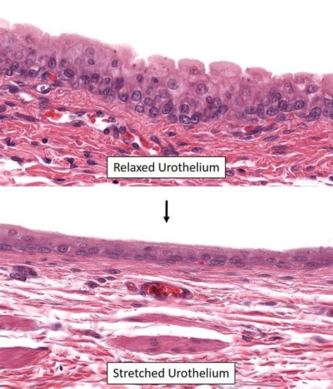 Urine elimination – Veterinary Histology