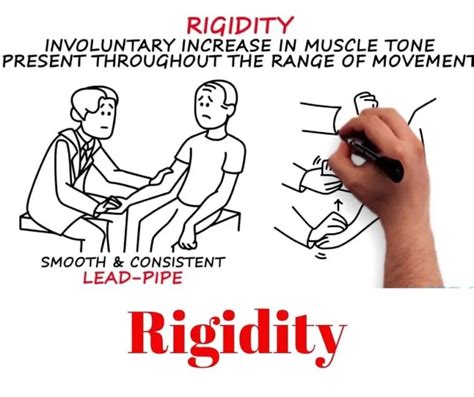 rigidity types Archives - Mobile Physiotherapy Clinic