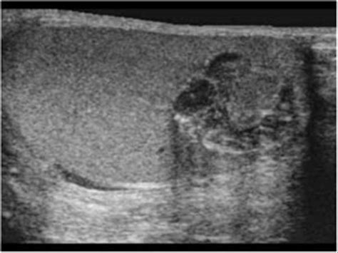 Ultrasound Cases | MedicineBTG.com