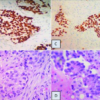 Histopathological comparison between pleural tissue obtained through ...