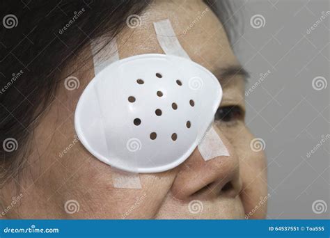 Eye Shield Covering After Cataract Surgery. Stock Photo - Image: 64537551