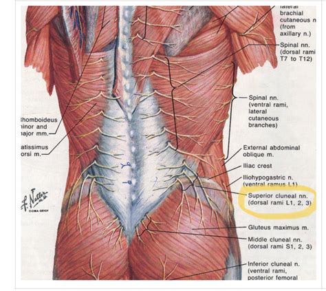 Low back pain related to cluneal neuropathy by fatty tissue compression ...