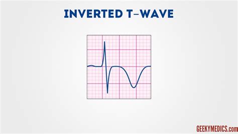 Download 6s ECG Learner ~ Medical Library