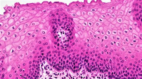 20 Unbelievable Facts About Epithelial Tissue - Facts.net