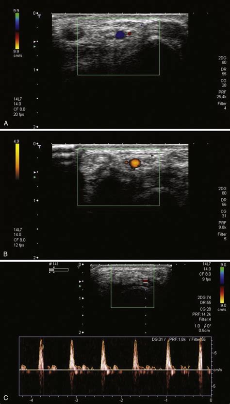 Physics of Ultrasound | Musculoskeletal Key