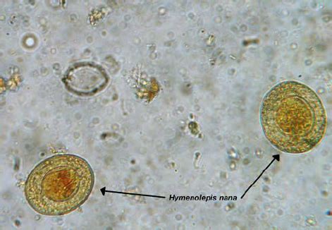 Hymenolepis Nana Life Cycle