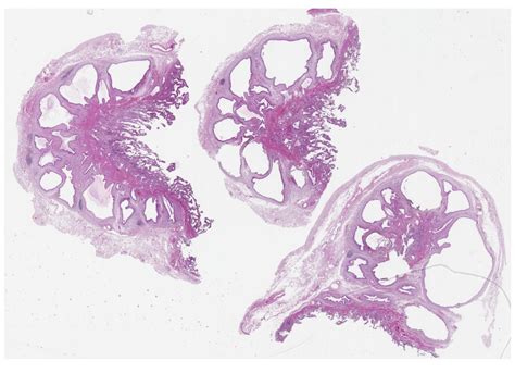 39 Gallbladder – Histopathology Atlas