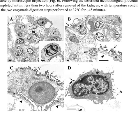 Transmission electron microscopy (TEM) of podocyte isolation procedure ...