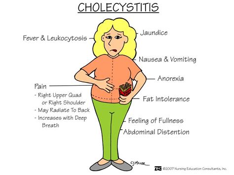 Pin on Nursing mnemonics