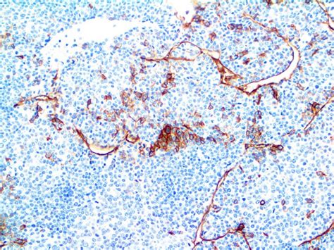 Claudin-5 Antibody (EP224) - Bio SB