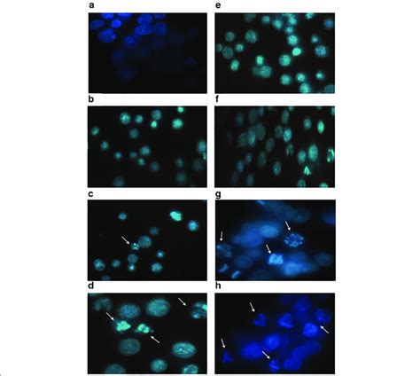 Apoptotic morphological changes in K562 cells. a K562 control cells ...