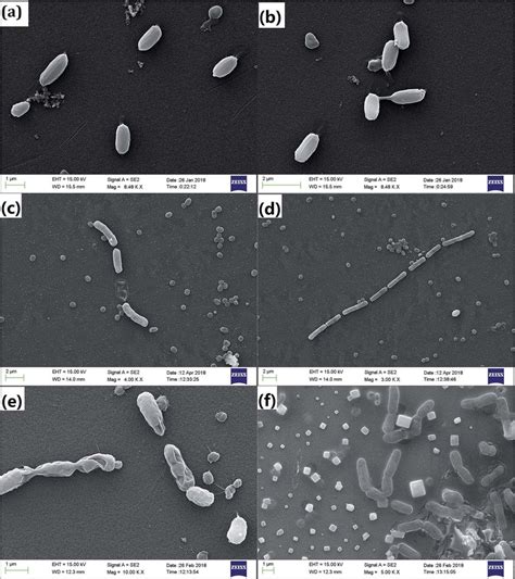 The morphology of A. faecalis incubated in different conditions ((a ...