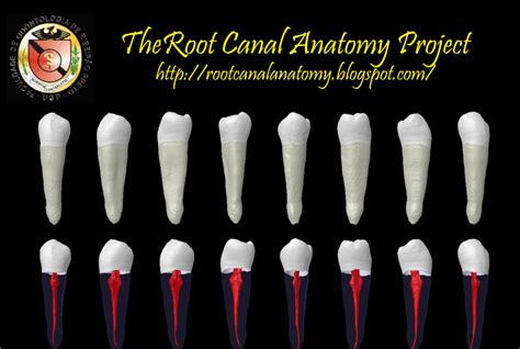 The Root Canal Anatomy Project: Mandibular First Premolar