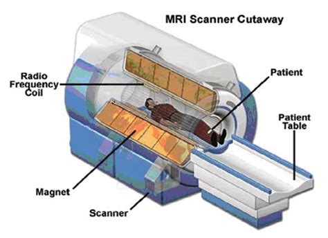 Imagerie par résonance magnétique