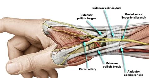 Tendon, Bone & Ligament causes: 1. DeQuervain’s tenosynovitis: Swelling of tendon of APL ...