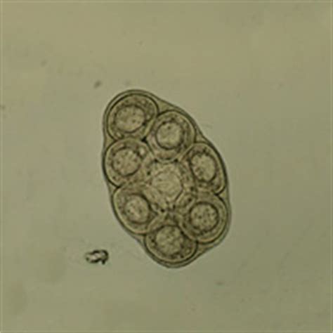 Dipylidium - Microscopy Findings