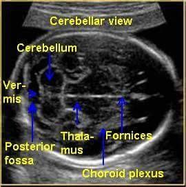 Ultrasound. Sonography. OB. | Medical ultrasound, Obstetric ultrasound, Diagnostic medical ...