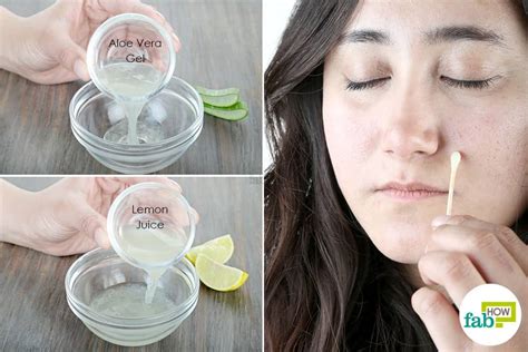 13 Ways to Remove Dark Spots with Lemon Juice | Fab How