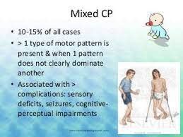 Mixed Cerebral Palsy - Cause, Symptoms, Treatment, Exercise