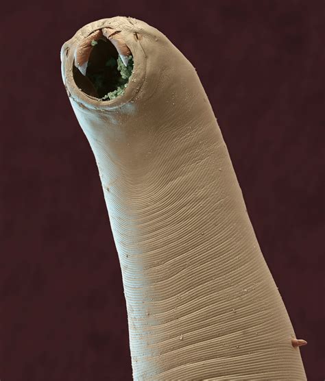 hookworm in humans - pictures, photos