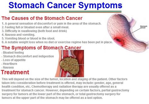 Stomach Cancer Symptoms Webmd - Stomach cancer symptoms / Unfortunately in the early stages of ...