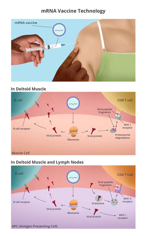 mRNA Vaccines for COVID-19 – How Do They Work? | EBSCO