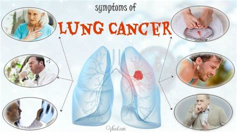 10 Early Symptoms Of Lung Cancer In Men And Women