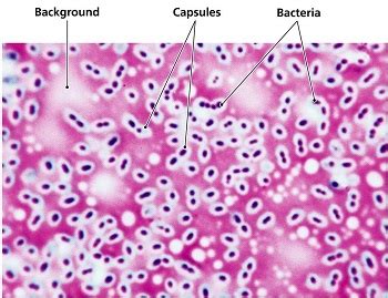 Capsule Staining - Introduction, Principle, Procedure, Result, Interpretation