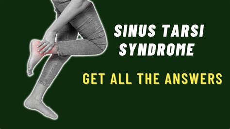 Sinus Tarsi Syndrome Explained by Foot Specialists - YouTube