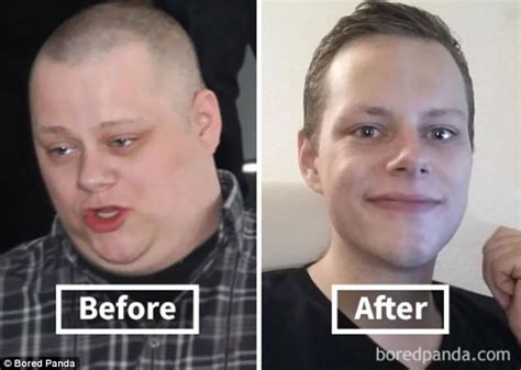 Transformations show what weight loss does to the face | Daily Mail Online