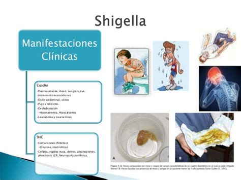 Shigella