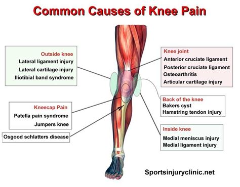 Where is your knee pain and what could be causing it? These are the ...